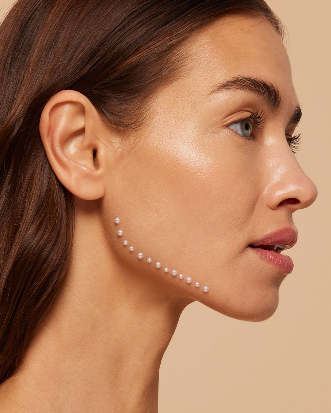 Jawline Hyaluron-Unterspritzung Frau